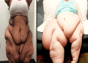 😱OMG !!! The Most Overweight People In The World