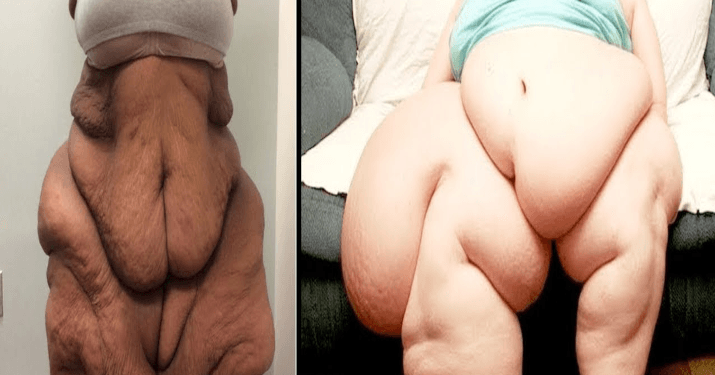 😱OMG !!! The Most Overweight People In The World
