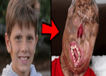 💥Heartbreaking news: 10 Brave People Who Survived The Impossible