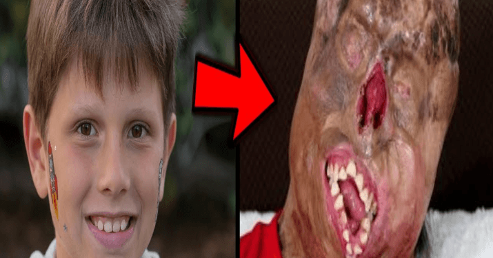 š„Heartbreaking news: 10 Brave People Who Survived The Impossible