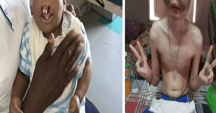 😭Very Sad: The Most UNUSUAL People With Rarest Mutation