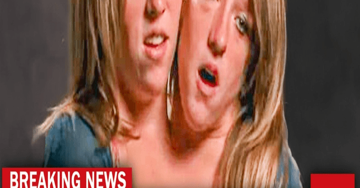 💥 Breaking news: Something TERRIFYING Happend To The Conjoined Twins Abby And Brittan