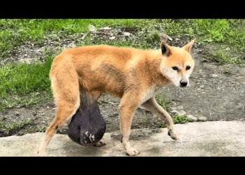 “Her 7kg Tumor Weighs Down Her Spirit, but She Keeps Walking Away from the World”