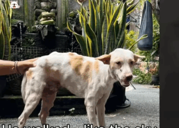 One Surgery. A Lifetime Lifted Off His Back_part2